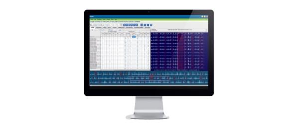 A product image of the HSCRIBE Holter Analysis System.