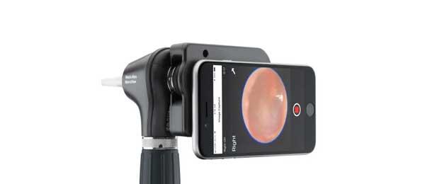 WELCHA ALLYN IEXAMINER PRO System with a MACROVIEW PLUS Otoscope